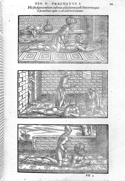 Woodcuts from a printed Latin edition of Avicenna's Canon, the textbook of Europe's medical faculties.